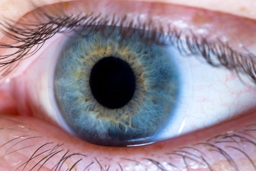 eye treatment, advance eye centre, best eye hospital